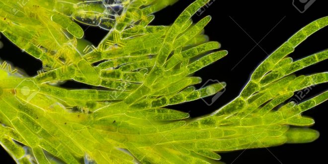 Green algae cladophora visible also diatoms cells darkfield illumination